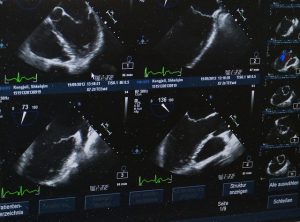 Ultraschallbilder können vom Arzt interpretiert werden.